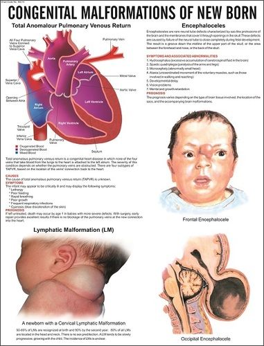 Congenital Malformation of New Born Chart