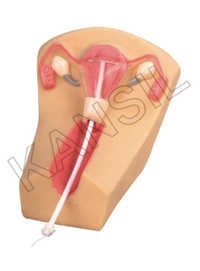 Iud Training Simulator Model - Anatomically Accurate Female Genitalia, Coronal Section With Transparent Observation Window For Insertion And Removal Training