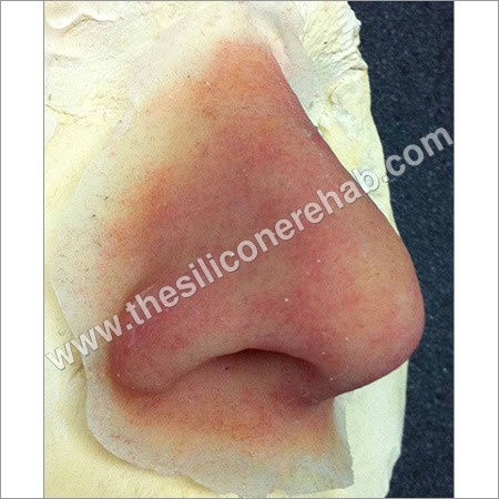 Artificial Nose