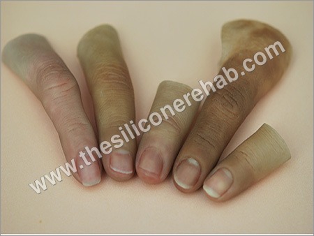 Finger Prosthesis