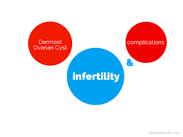 Infertility treatment