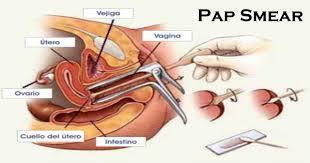PAP Smear