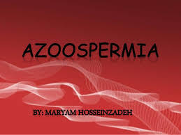 Azoospermia Treatment