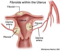 Operation of Uterus
