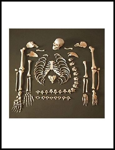 Disarticulated Human Skeleton (bilateral)