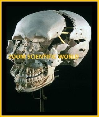 Disarticulated Skull