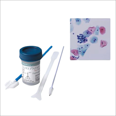 Liquid Based Cytology