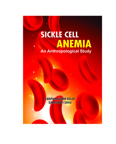 Glossy Paper Sickle Cell Anemia: An Anthropological Study