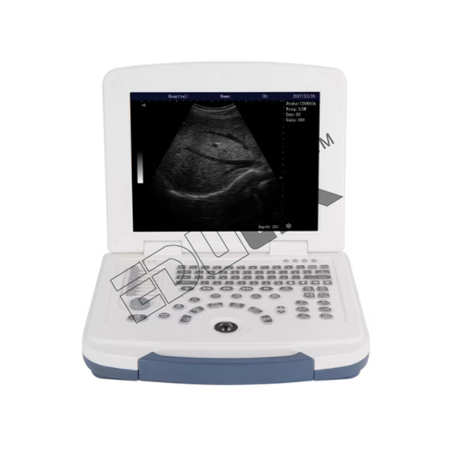 Portable Ultrasound Pregnancy Detection Apparatus