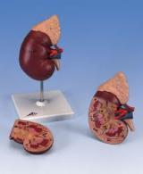 KINDNEY AND ADRENAL GROUND - Plastic Model, 26cm Height, Divisible with 20 Anatomical Points , Hand-Coded Parts on Pedestal Base