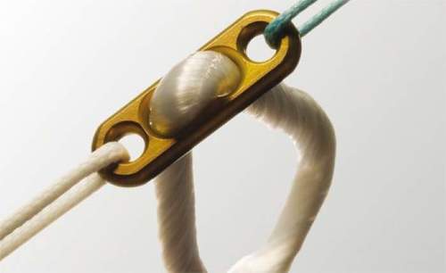 ऑर्थो प्रत्यारोपण