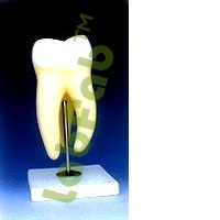 HUMAN TOOTH, UPPER TRIPLE ROOT - 15x Enlarged, 2-Part Longitudinal Section | Caries Detail, 3 Roots, Pulp Cavity, Educational Stand with Key Card