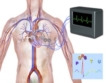 ECG Machine