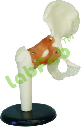 HIP JOINT