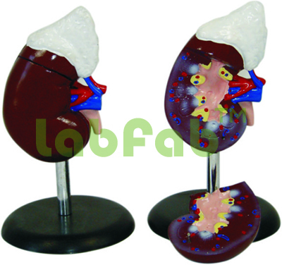 HUMAN KIDNEYS WITH ADRENAL GLANDS