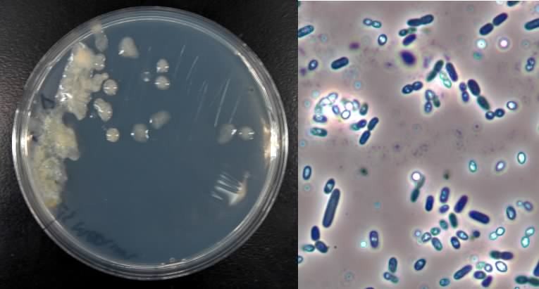 Azotobacter chroococcum By PUSHPA J. SHAH