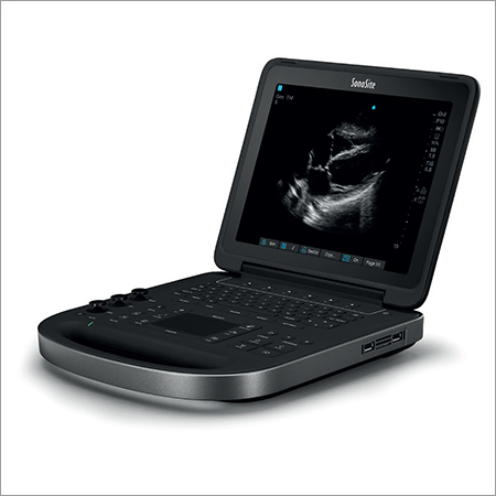 Sonsoite Edge Transducer