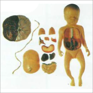 Fetus With Viscus and Placenta