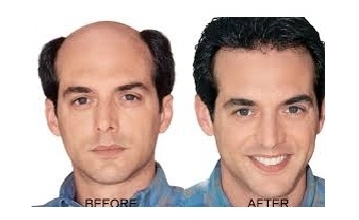 Hair Fixing Center in Kolkata