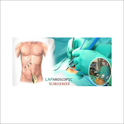 Laparoscopic Gastrointestinal Surgery