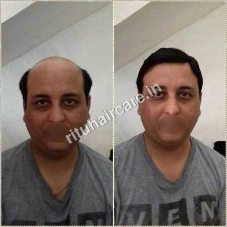 Men's Hair Patch Wigs