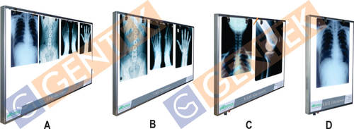 Led X-ray View Box