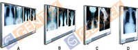 Led X-ray View Box - Sleek Aluminum Design, Ultra Bright Illumination For Optimal Image Clarity