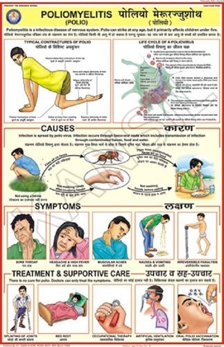 Poliomyelitis (Polio) Chart