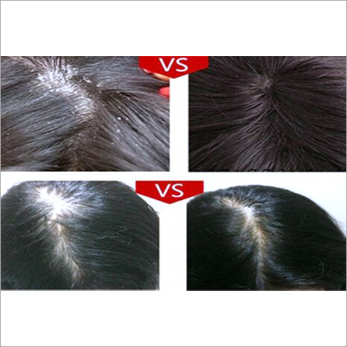 Brazilian Keratin Smoothing System