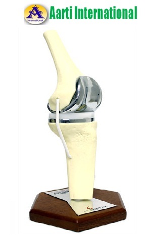 White Knee Implant Model