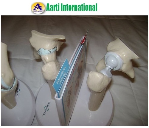 White Hip Implant Anatomical Model