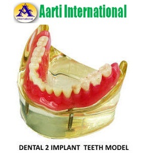 White Dental 2 Implant Teeth Model