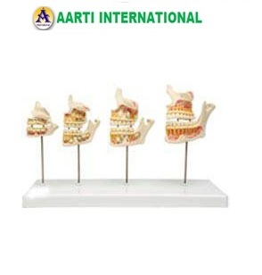 White Dentition Development Set