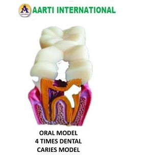 White Oral Model 4 Time Dental Caries Model