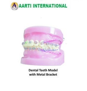 Dental Teeth Model With Metal Bracket