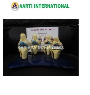 4 Stage Osteoarthritis Model - Pvc Material, 14x10x10 Cm Size | High Strength, Crack Resistant, Ideal For Biology Teaching