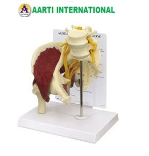 White Muscled Hip With Sciatic Nerve