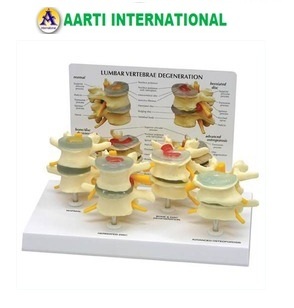 White Vertebrae Degeneration Models