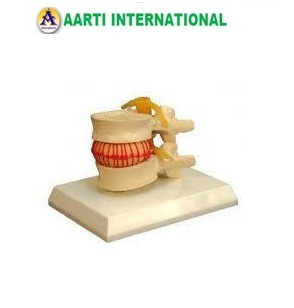 White Disc Prolapse Simulator Model