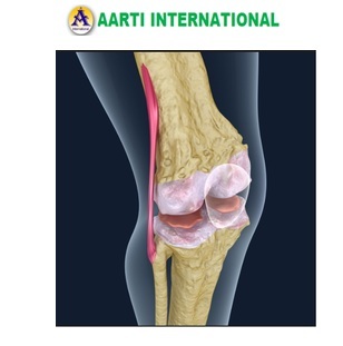 White Osteoporosis Model