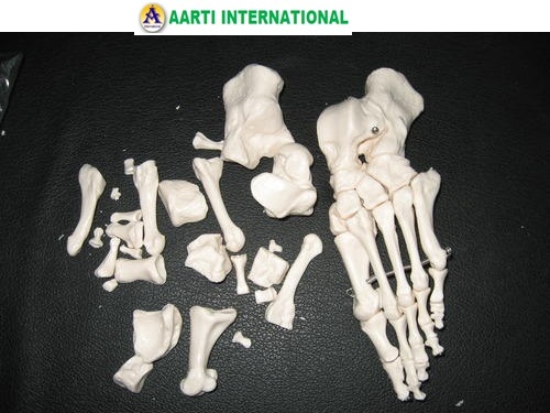 Loose Bones
