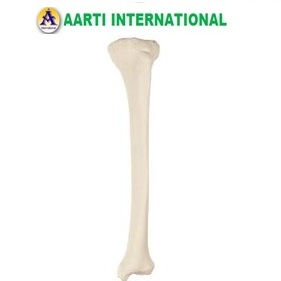 Loose Bones