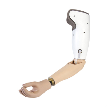 Above Elbow myo Hand Prosthesis