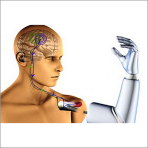 Elbow Disarticulation Myo Hand Prosthesis