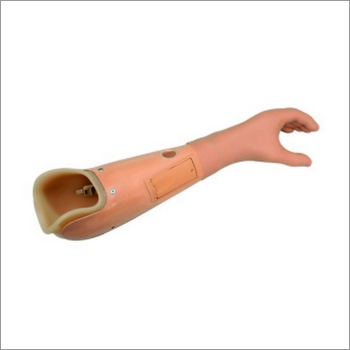 Below Elbow Myo Hand Prosthesis