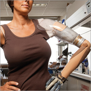 Shoulder Disarticulation Myo Hand Prosthesis