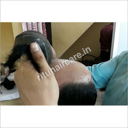 Non Surgical Advanced Hair Bonding