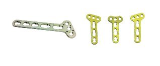 Lock-In (ALT) Distal Radius Plate - Stainless Steel & Titanium, 3-5 Holes, Left/Right/T, Strong Fixation, Anatomical Fit