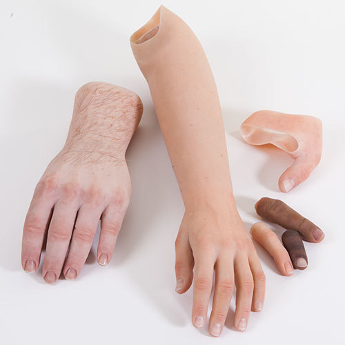 Cosmetic Hand Prosthesis