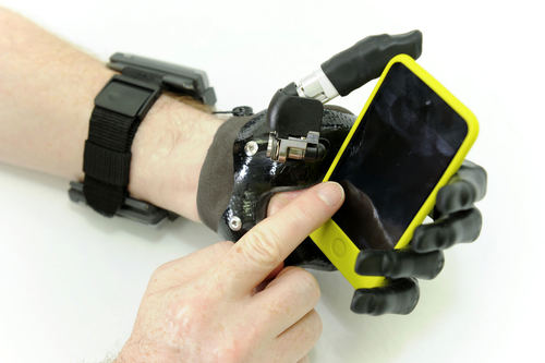 I-limb digit for partial hand